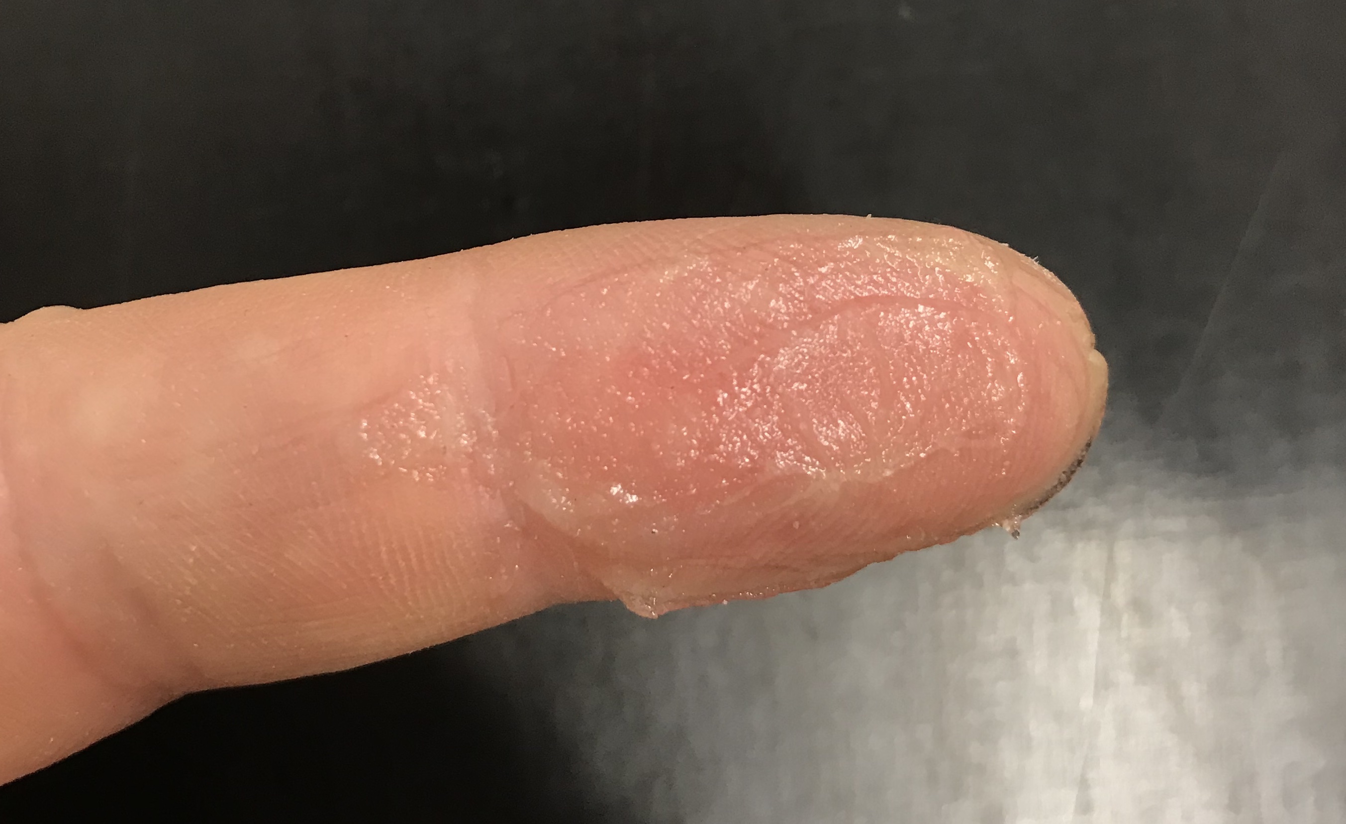 Paste auf dem Finger