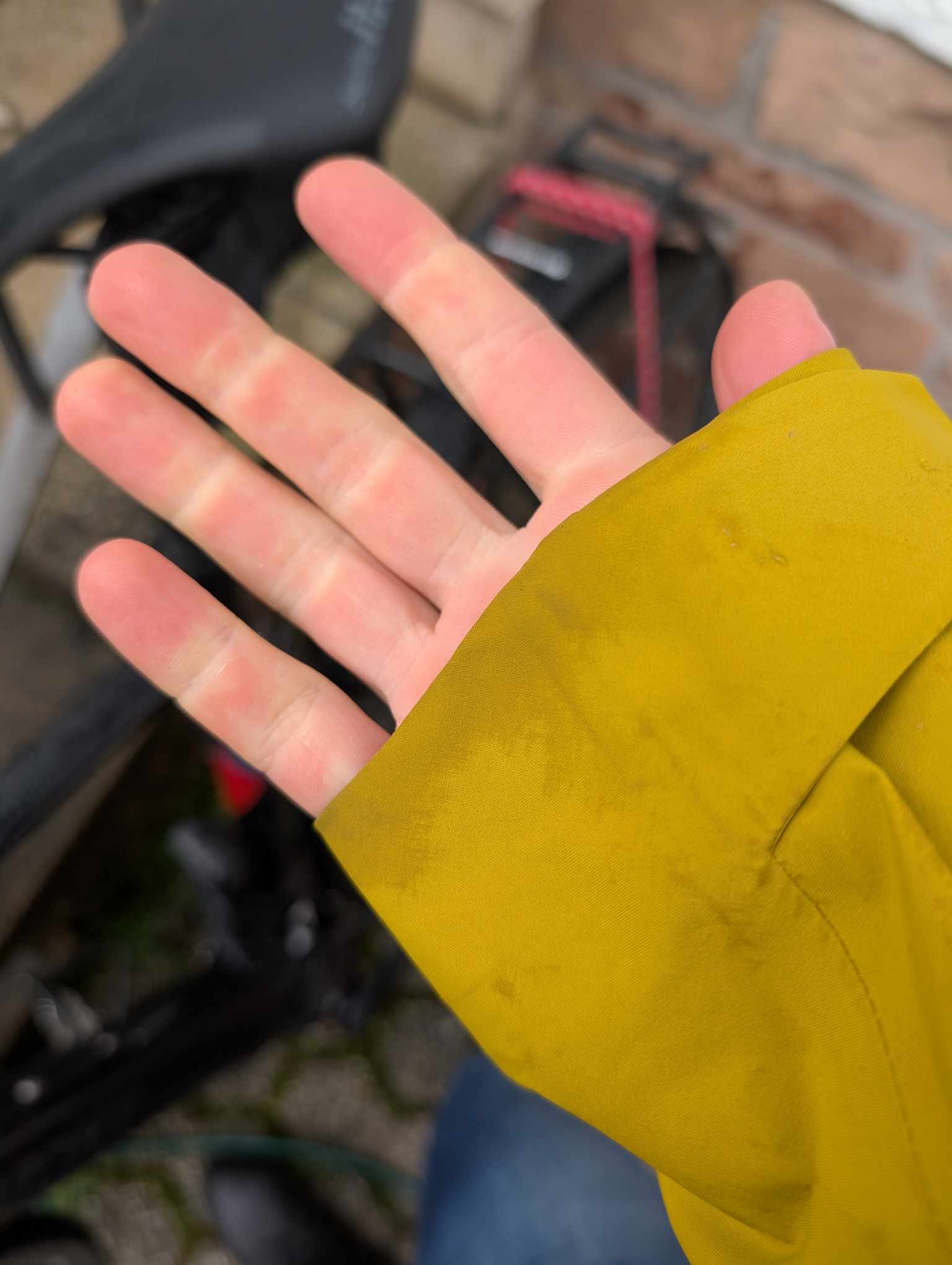 Man sieht den Bund am Arm von Außen 
