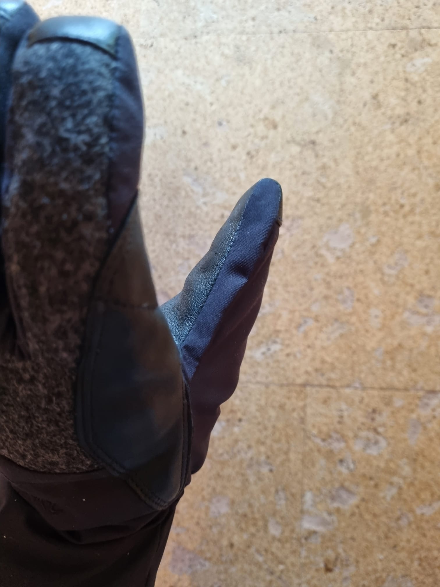 fehlendes Leder zwischen Daumen und Zeigefinger