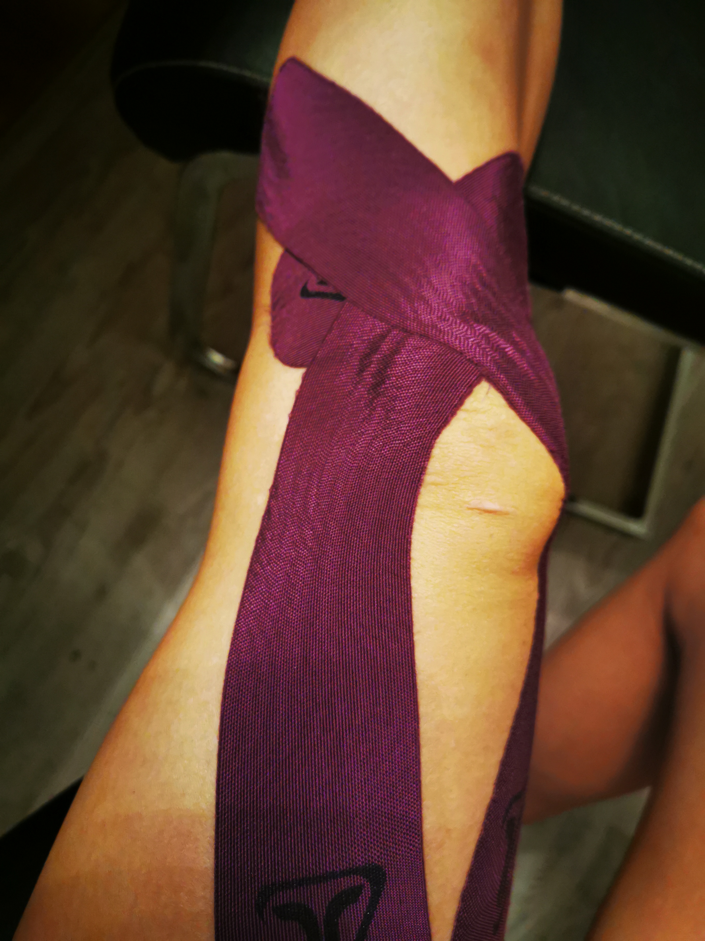 Knie