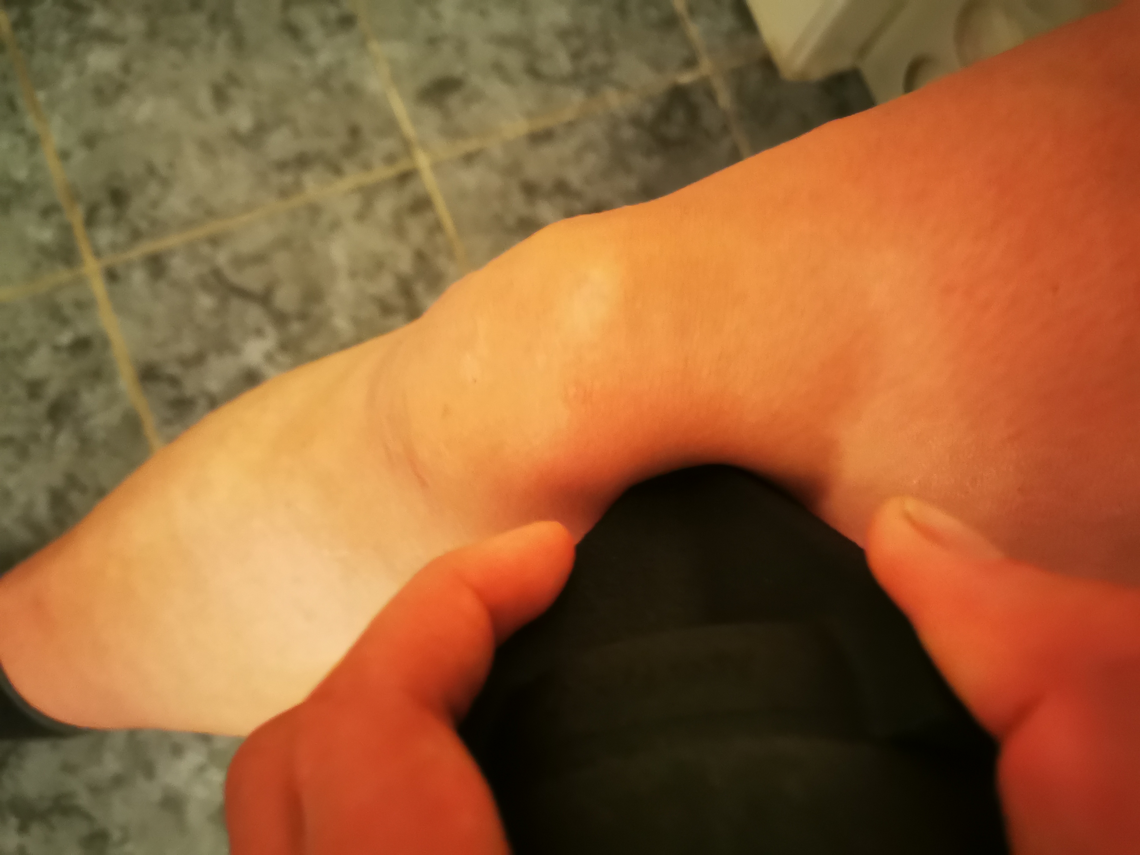 Behandlung rund um die Kniescheibe