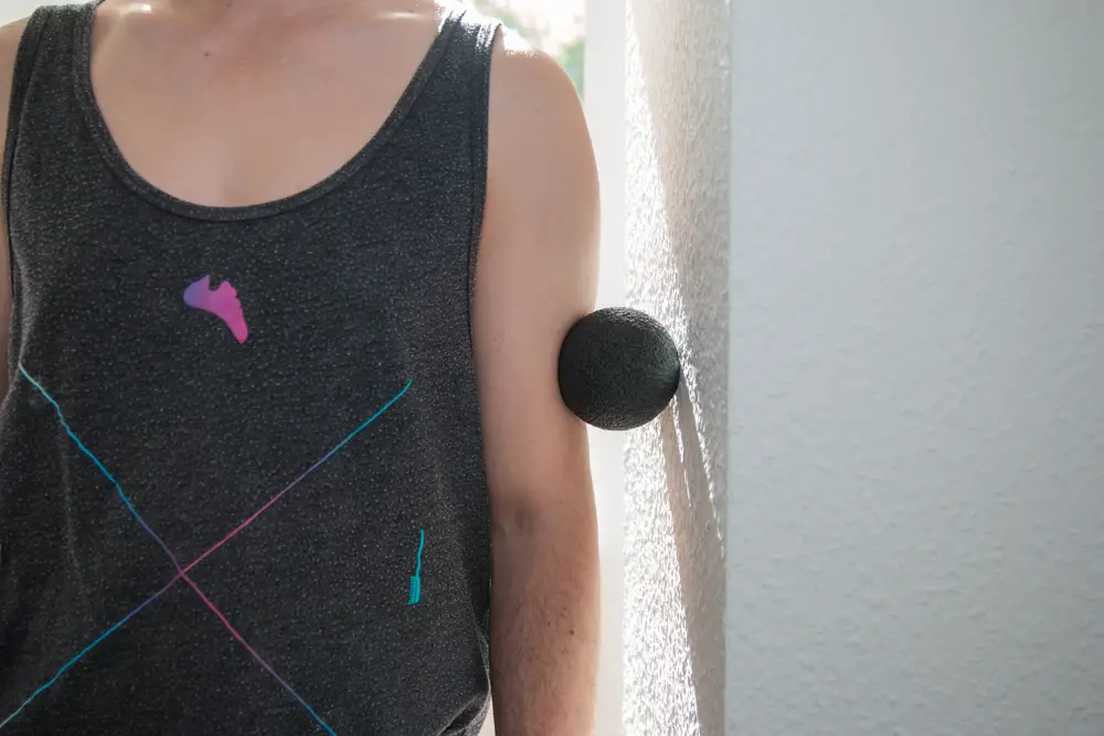 Arm