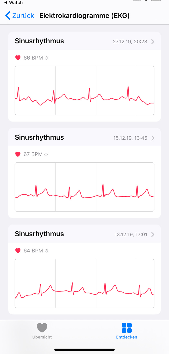 ekg
