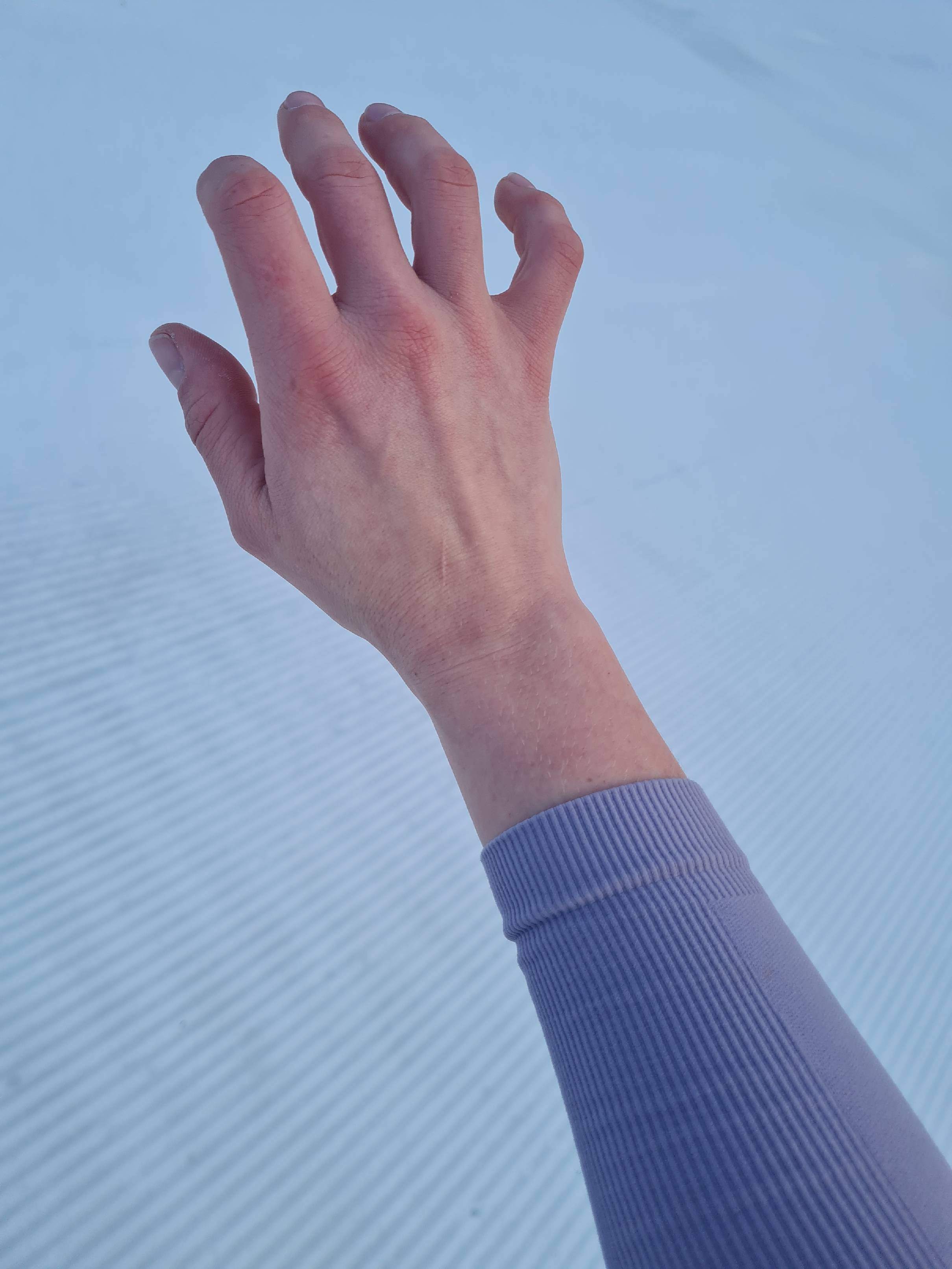 kurzer Arm