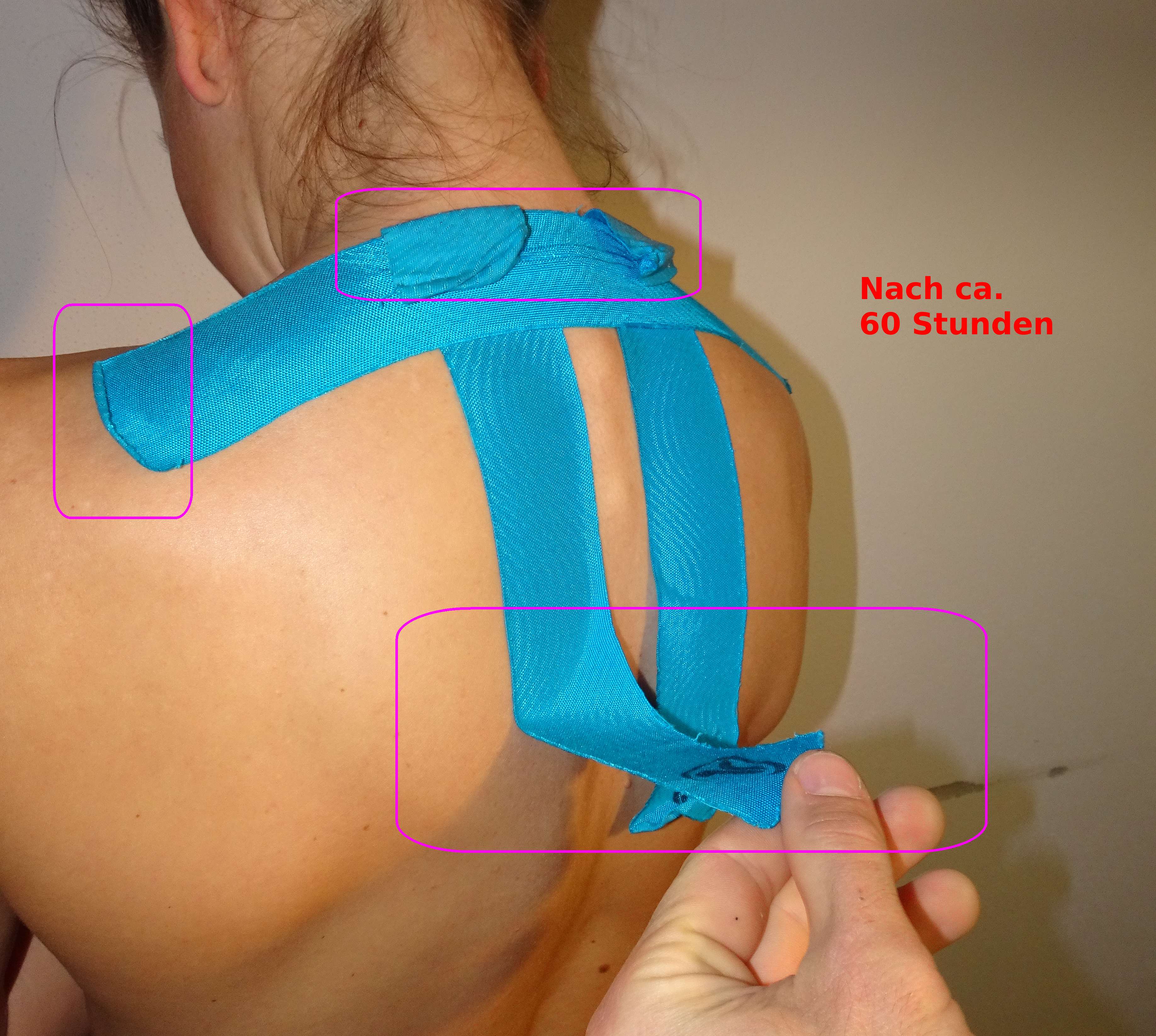 Nacken 60h